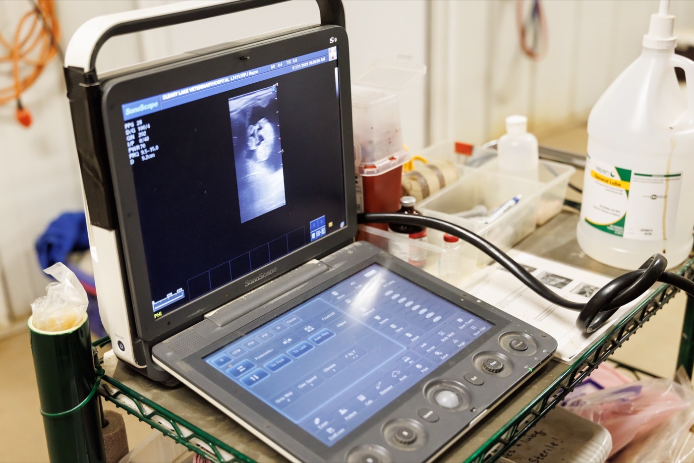 A portable ultrasound unit showing a reproductive scan